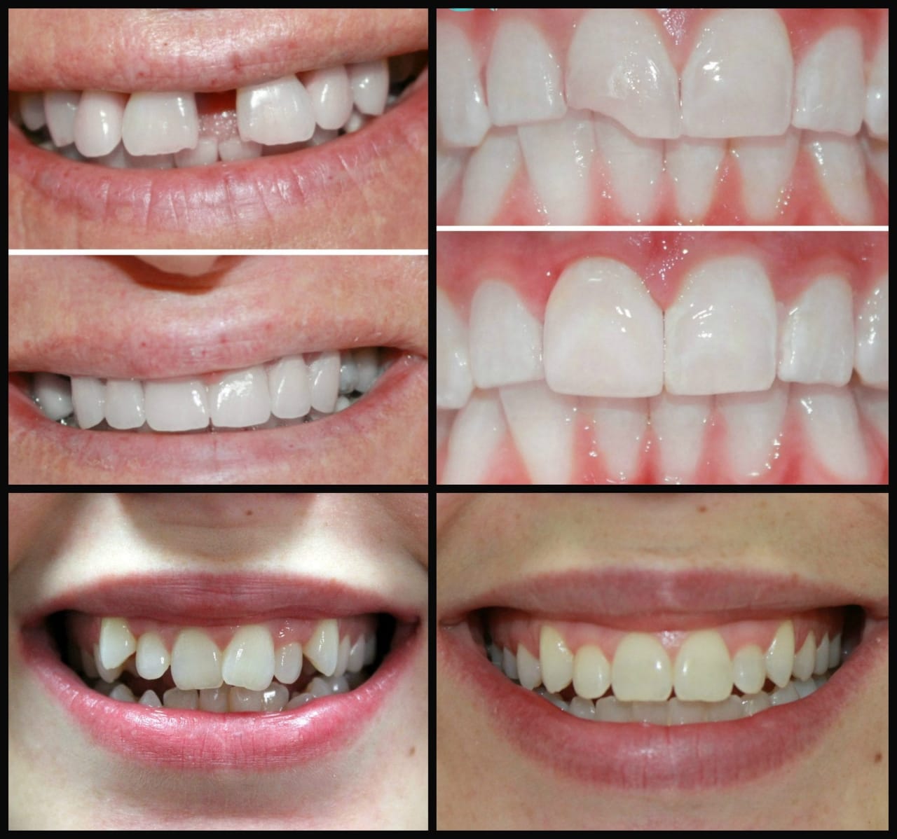 Modern Dental Clinic & Orthodontic Centre Erumely