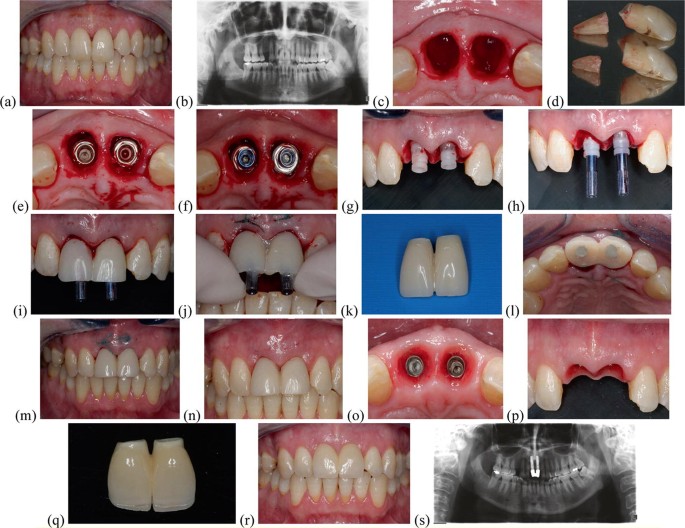 Modern Dental Clinic & Orthodontic Centre Erumely
